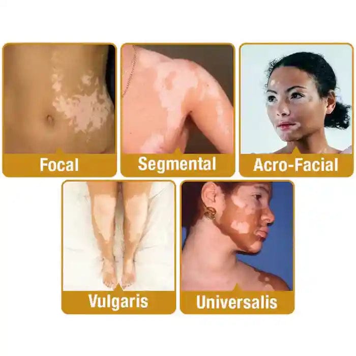 New Revitalizing Bee Venom Cream Natural Skin Restoration.